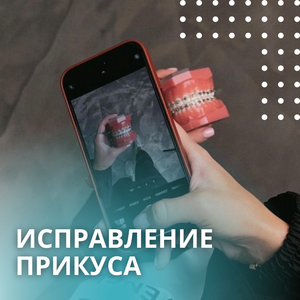 Брекеты
