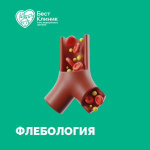 Флебология
