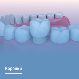 Коронки для зубов
