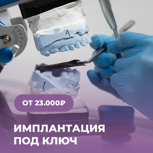 Имплантация под ключ