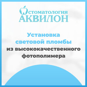 Световая пломба