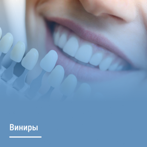 Виниры для зубов