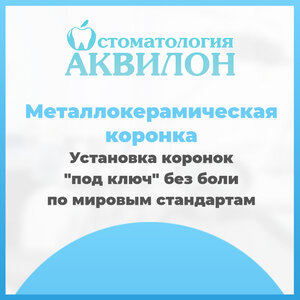 Металлокерамическая коронка 