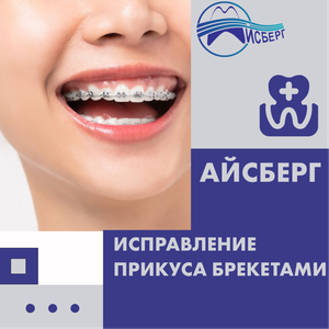 АКЦИЯ на мини-брекеты в СПб! Стоматология 24/7 для вас!