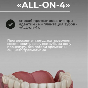 Протезирование на имплантах