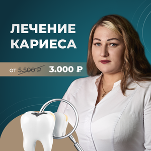 Лечение кариеса в Уфе - от 3000 р.