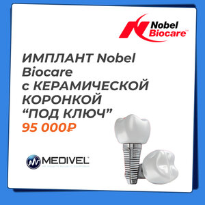 Имплант Nobel Biocare c керамической коронкой “Под ключ”