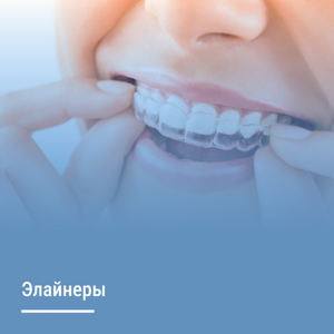 Установка элайнеров