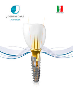 Внутрикостная дентальная имплантация JDICon Plus