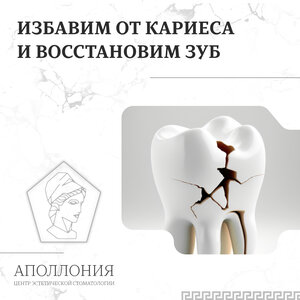 Лечение кариеса