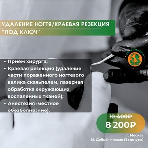 Удаление ногтя под ключ / краевая резекция