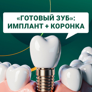 «Готовый зуб»: имплант + коронка