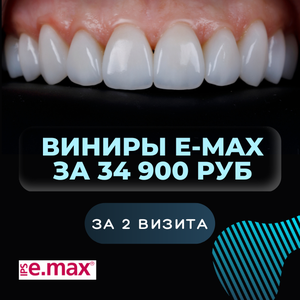 Виниры E-Max со скидкой 34 900 руб