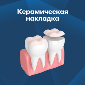 Керамическая накладка