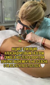 Акция на александритовый лазер candela
