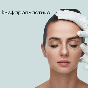 Блефаропластика