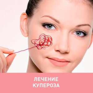 Лазерное лечение купероза (носогубный треугольник)