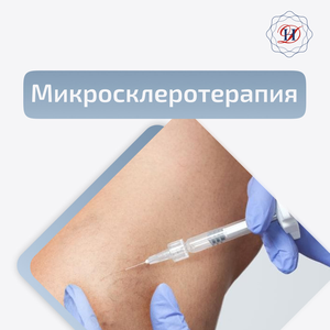 Микросклеротерапия со скидкой 28%