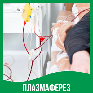 Плазмаферез