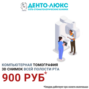 Компьютерная томография (КТ) 3D снимок всей полости рта