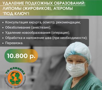 Удаление подкожных образований: - "ПОД КЛЮЧ"! 10800Р!