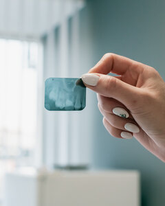 Прицельный рентген 