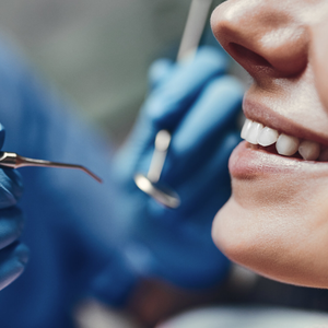 Комплексные предложения Dental Check up