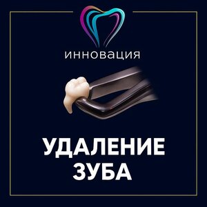 Удаление зуба от
