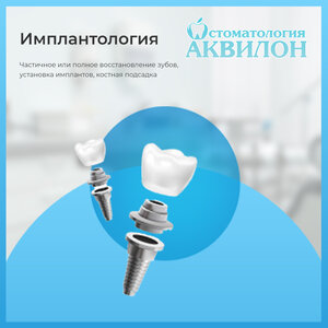 Одномоментная и классическая имплантация зубов