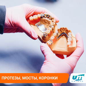 Бюгельный (бугельный) зубной протез. Мосты, коронки