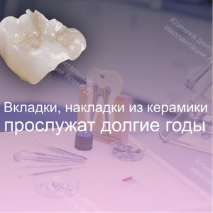Керамические вкладки и виниры