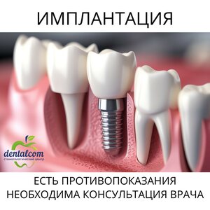 Имплантация зубов