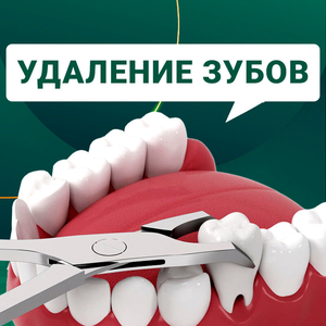 Удаление зубов