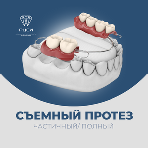 Съемный протез (Частичный/Полный)