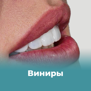Виниры