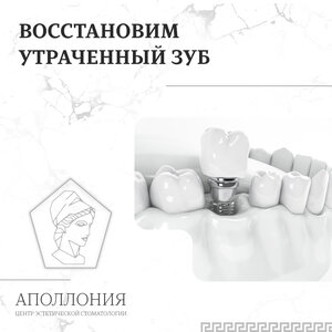 Имплантация