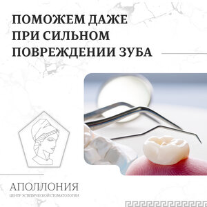 Протезирование