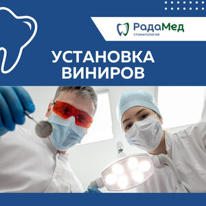 Установка виниров