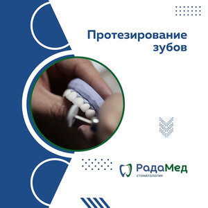 Вкладки и накладки керамические E-max