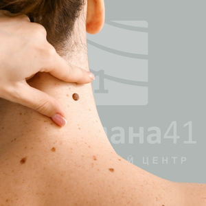 Удаление новообразований 