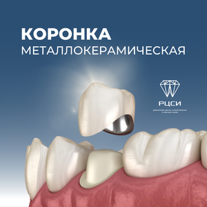 Коронка металлокерамическая