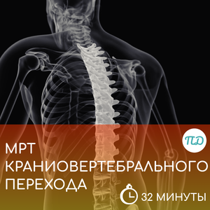 МРТ краниовертебрального перехода