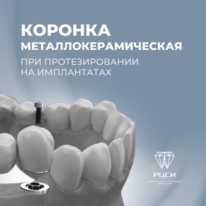 Коронка металлокерамическая при протезировании на имплан