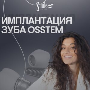 Имплантация зуба Osstem от