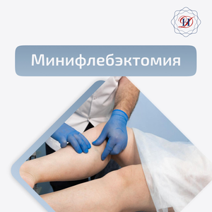 Минифлебэктомия со скидкой 35%