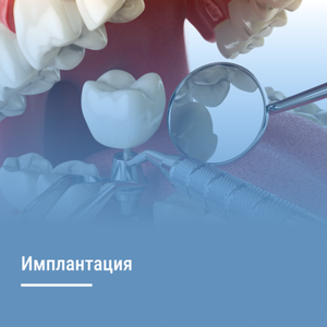Имплантация зубов