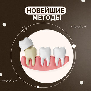 Установка коронок