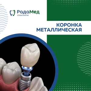 Металлическая коронка