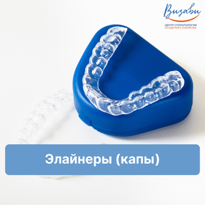 Выравнивание зубов элайнерами (капа)