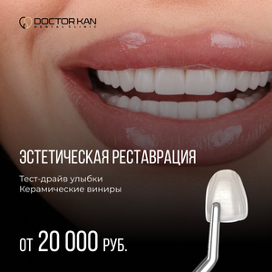 Тест-драйв улыбки 